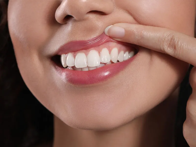 Woman looking at gums